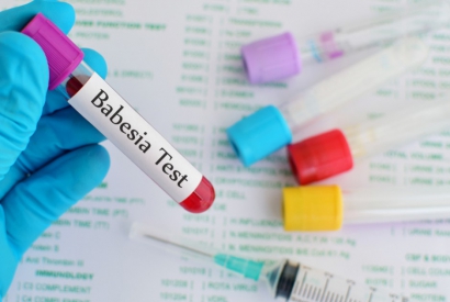 Sočasne okužbe z lajmsko boleznijo – Babesia
